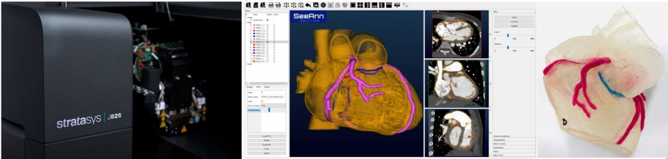 의료영상기반 3D모델링 화면: 3D프린팅으로 선천성 심장질환 수술 시뮬레이션 모형